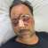 Greek Canadian beaten severely by Cretan thugs